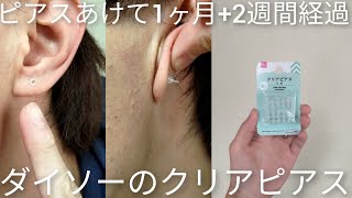 【開通】ピアスホール開けて１ヶ月と２週間経過。ダイソーの｢透明ピアス｣を装着してみます。 [upl. by Noid822]