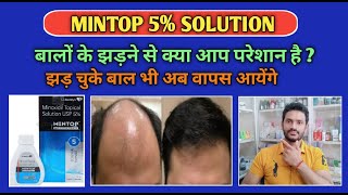 Mintop 5 solution use benefits and Side effects full review hindiminoxidil [upl. by Acenom349]