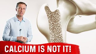 Osteoporosis Is Not a Calcium Deficiency – Remedies for Osteoporosis – DrBerg [upl. by Sapphira]