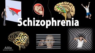 Schizophrenia Symptoms Cause Pathophysiology Diagnosis and Treatments Animation [upl. by Thatcher600]