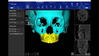 How to use the FaceGIDE Setup module EN [upl. by Apurk198]