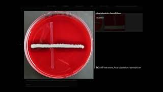 Reverse CAMP Test Arcanobacterium haemolyticum  Microbiology [upl. by Haianeb]