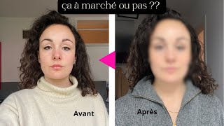 COMMENT JAI AFFINÉ MON VISAGE EN 7 JOURS  AVANT APRES [upl. by Yenattirb]