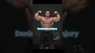 Denis before injury💔 vs after injury😭 deniscyplenkov armwrestling denis [upl. by Dareece]