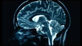 Why Religion causes brain damage [upl. by Odama]