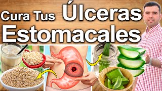 Cómo Curar Las Úlceras Estomacales  Elimina Las Úlceras Del Estómago Naturalmente [upl. by Aidnahs]