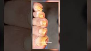 Nails satisfying pedicure shorts satisfying nails pedicure [upl. by Eenhpad]