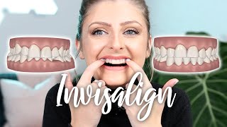 I GOT INVISALIGN  IN DEPTH All About My Teeth  1 Week Review  TIPS [upl. by Ayatan]