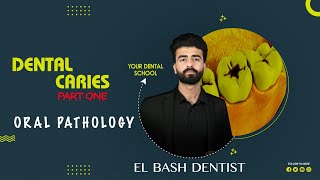 dental caries  part 1  oral pathology  عزت شومان [upl. by Ailito680]