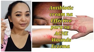 Antibiotic Cream na Effective treatment  Para sa Wounds ACNE at Eczema [upl. by Anema187]