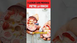 DE CE CONTINUI SA FACI PIETRE LA RINICHI shorts [upl. by Menides]