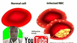 DRUGS USED TO TREAT MALARIA AND THEIR MODE OF ACTION ANTMARIALS AND EXAMPLES [upl. by Belloir]