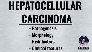 Hepatocellular Carcinoma  HCC   Pathophysiology  Morphology  Clinical features [upl. by Eveneg]