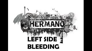 Hermano  Left Side Bleeding [upl. by Barnaby643]