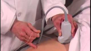 How To Ultrasound Guided Hip Injection Scanning Technique Video [upl. by Calista788]