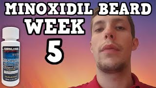 Minoxidil Beard  Week 5  Minoxidil 5 for Beard Growth  Facialfuzzfridays [upl. by Eniamraj831]