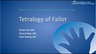 Tetralogy of Fallot [upl. by Ragnar]