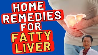 Home Remedies for Fatty Liver [upl. by Gad]