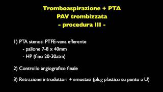 Tromboaspirazione  PTA angioplastica protesi arterovenosa interventional nephrology AVF dialysis [upl. by Kris15]