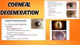 corneal degeneration classification  symptoms  treatment  ophthalmology  English [upl. by Acinorrev]