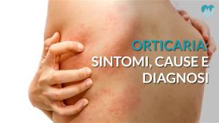 Orticaria sintomi cause e diagnosi [upl. by Leahcimnhoj]