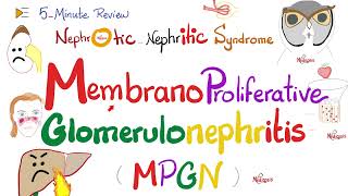 Membranoproliferative Glomerulonephritis Type 1 and 2  MPGNI amp MPGNII  Nephrology [upl. by Amory]