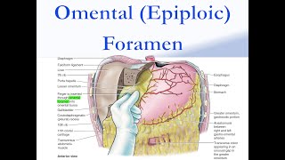 Omental Epiploic Foramen [upl. by Oiragelo]