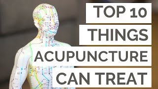 The Top 10 Conditions Acupuncture Can Help [upl. by Neo]