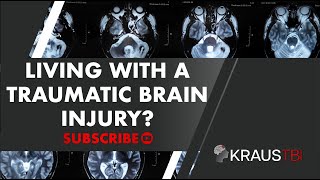 Living With a Traumatic Brain Injury  Neurosurgeon Dr Gary Kraus Houston  Kraus TBI Podcast [upl. by Chrissa]