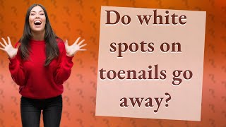 Do white spots on toenails go away [upl. by Holsworth]