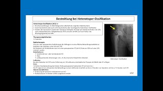 Bestrahlung vom heterotoper Ossifikation  Strahlentherapie Prof Hilke Vorwerk [upl. by Pilar903]