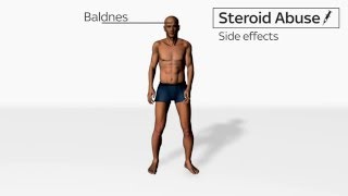 Side Effects of Steroids Abuse [upl. by Johnathon]