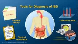 Diagnosing IBD [upl. by Hufnagel]