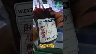 Whole blood  blood donation  blood bank transfusion medicine  blood bank  Fresh blood [upl. by Athallia]