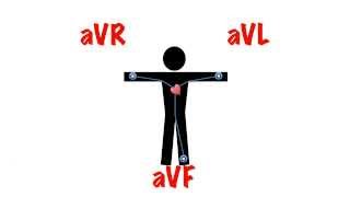 ECG Cardiac Axis [upl. by Asena]