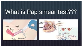 An overview of Pap smear test [upl. by Cosetta792]