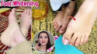 Instant Feet Whitening Successful DIY Tan Removal at Home Easy Steps [upl. by Lindley]