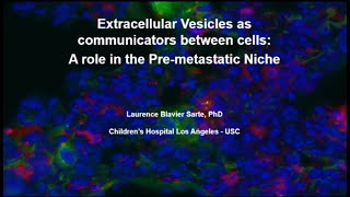 Extracellular Vesicles as Communicators Between Cells  A Role in Cancer Dissemination [upl. by Tad]