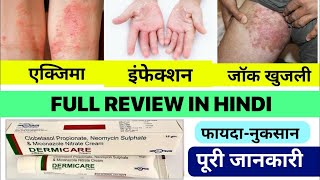 clobetasol propionate neomycin sulphate and miconazole nitrate cream uses  Dermicare cream review [upl. by Yajiv471]