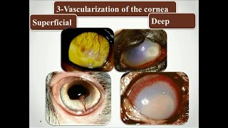 Affections of the cornea part 6 [upl. by Ennasus]