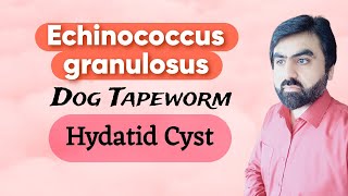 Lec15  Echinococcus granulosus  Hydatid Cyst  Life cycle  Cinical finding  Lab diagnosis Eng [upl. by Gaston]