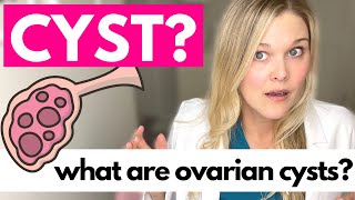 OVARIAN CYSTS What Causes Ovarian Cysts [upl. by Renwick493]