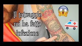 Il tatuaggio mi ha fatto infezione Tattoo Infection  The Bonnie [upl. by Thetisa870]