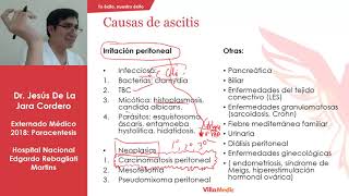 PARACENTESIS [upl. by Dorahs]