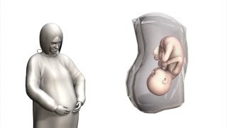 Clinic offers 3D models of unborn babies [upl. by Rdnaskela]