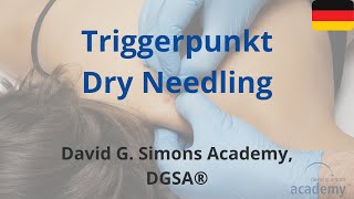 Triggerpunkt Dry Needling [upl. by Thayne]