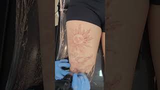 Apagando o sol a laser  Remoção de Tatuagem [upl. by Ahrat]