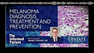 Melanoma diagnosis treatment and prevention [upl. by Oinimreh]