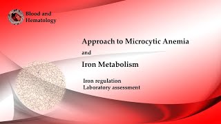 Approach To Microcytic Anemia [upl. by Colner]