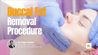 Buccal Fat Removal Surgery  Cheek Fat Reduction  Face slimming Dr Rajat Gupta  RG Aesthetics [upl. by Airetnuhs]